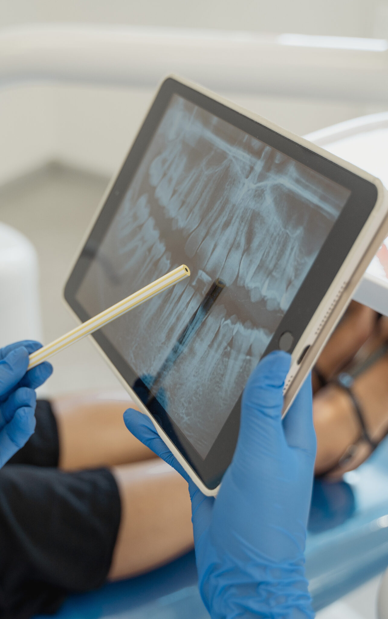 analise-de-design-de-dispositivo-cirurgico