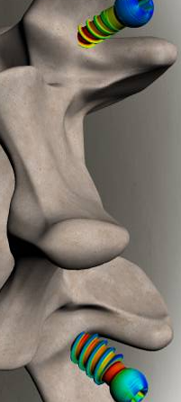 analise-de-elementos-finitos-em-parte-ossea