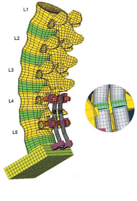 analise-elementos-finitos-em-coluna-com-uso-de-dispositivos-inovadores