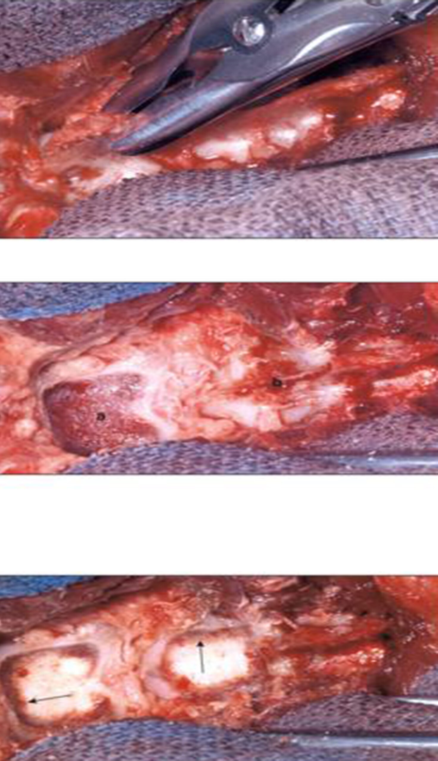 manipulacao-de-peca-cadaverica-para-teste