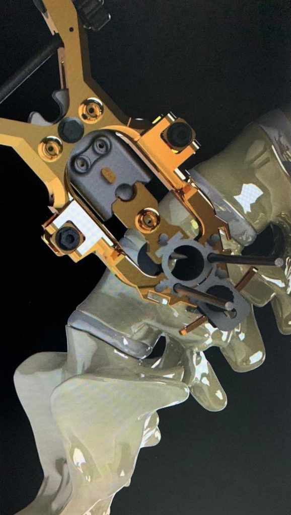 simulacao-avancada-em-dispositivos-cirurgicos