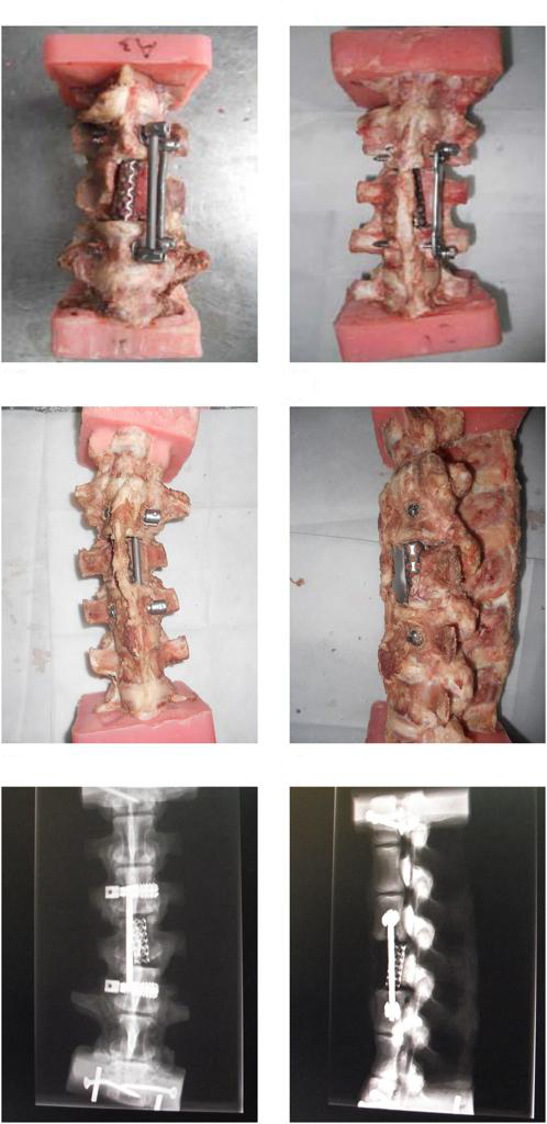 teste-certificador-em-coluna-vertebral-com-dispositivos